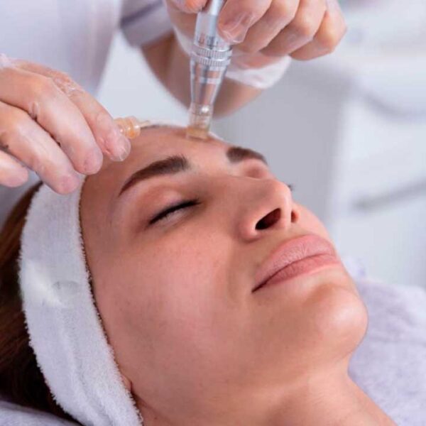 Microneedling and Exosomas Barcelona