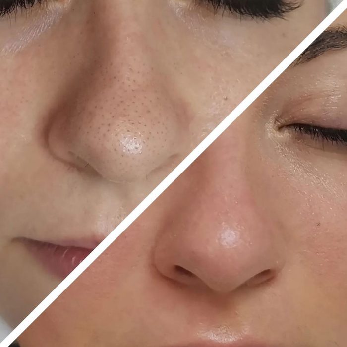 dina dascal limpieza facial